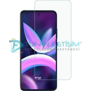 Honor X400 Pro Ekran Değişimi - Görsel 2